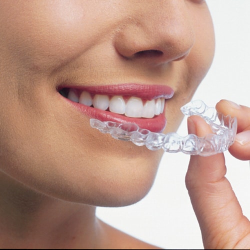 Boulder Invisalign