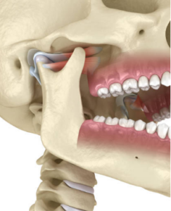 Illustration of a skeleton with TMJ highlighted