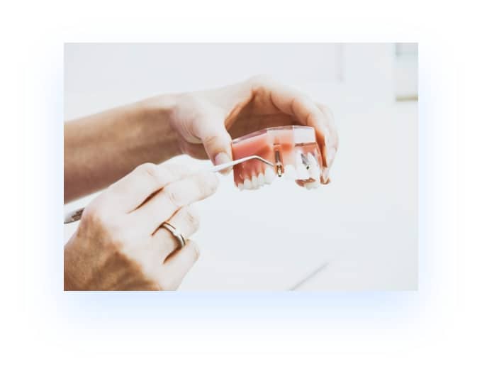person's hands holding fake teeth showing restorative dentistry procedure